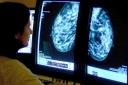 While young women can get breast cancer, it is more common in women over 50