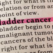 Five-year survival rates for bladder cancer in Scotland are the lowest in Europe